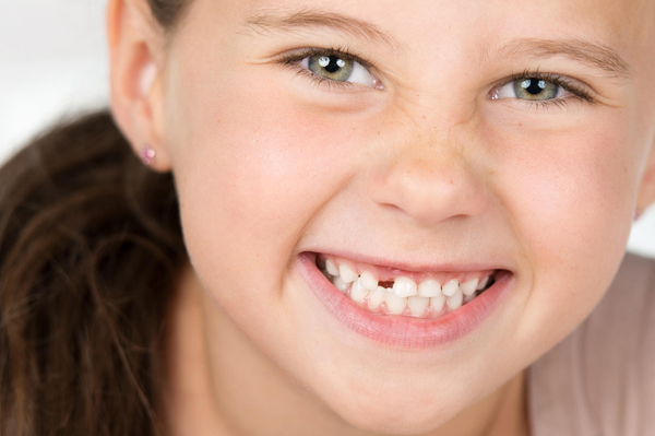 Girl Missing Tooth